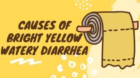 Bright Yellow Watery Diarrhea 6 Causes Simplified By A Gut Doctor Oh   Causes Of Bright Yellow Watery Diarrhea 480x270 